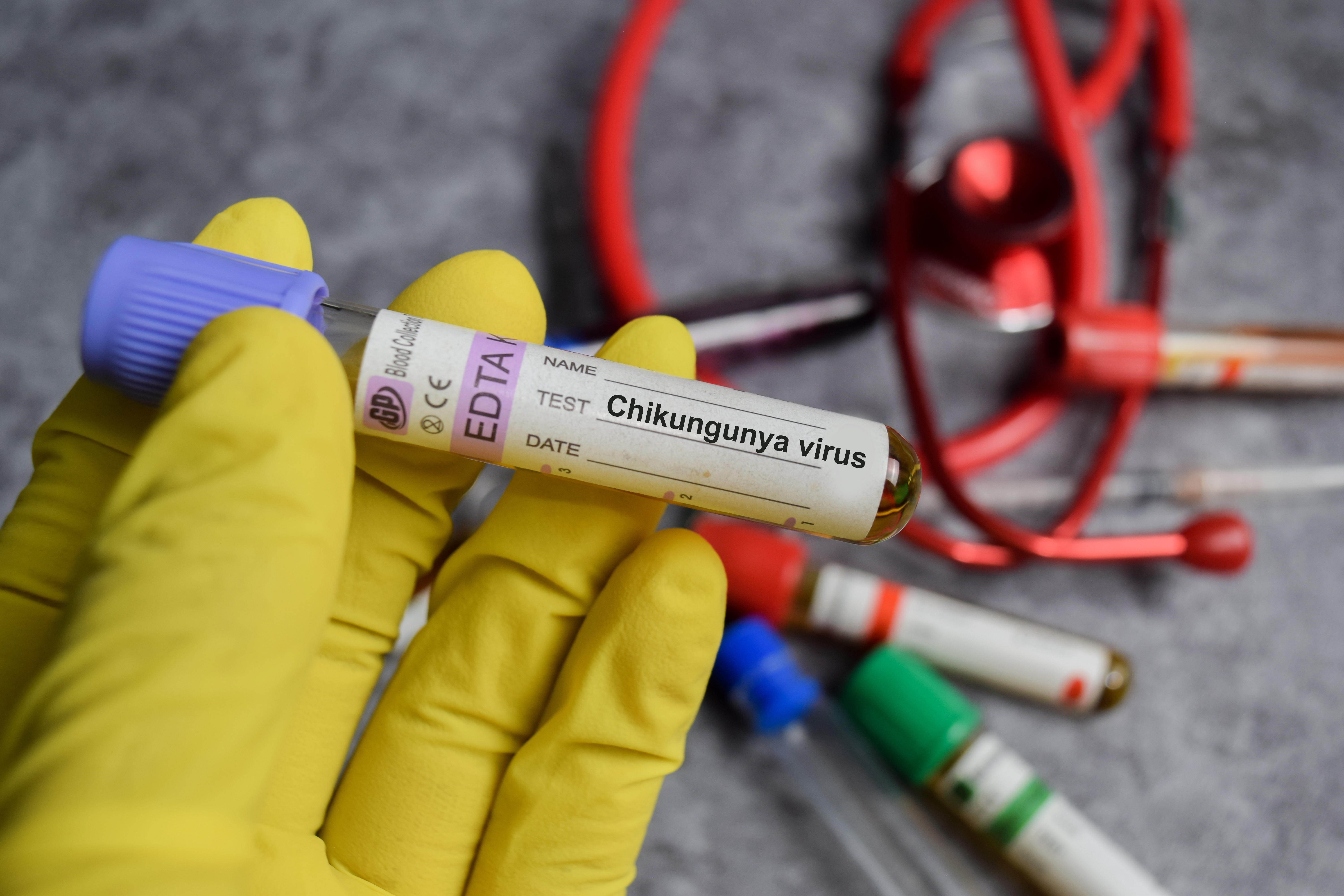 Image for New York reports first locally transmitted case of chikungunya virus