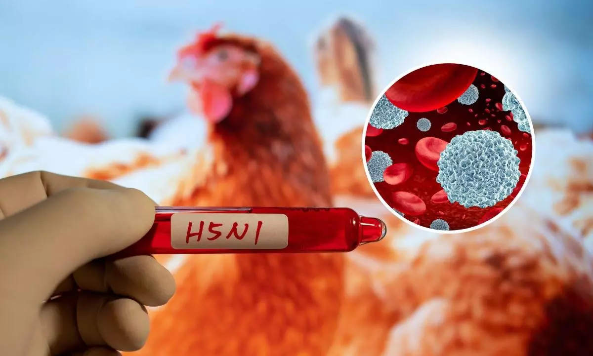 Image for Mexico reports new human case of H5 bird flu in Mexico City