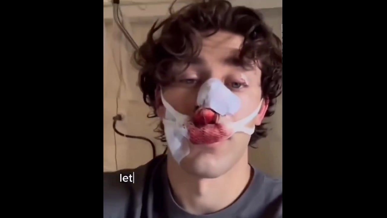 [Video] American Hero Stabbed Defending Girl in Germany; Suspect Released