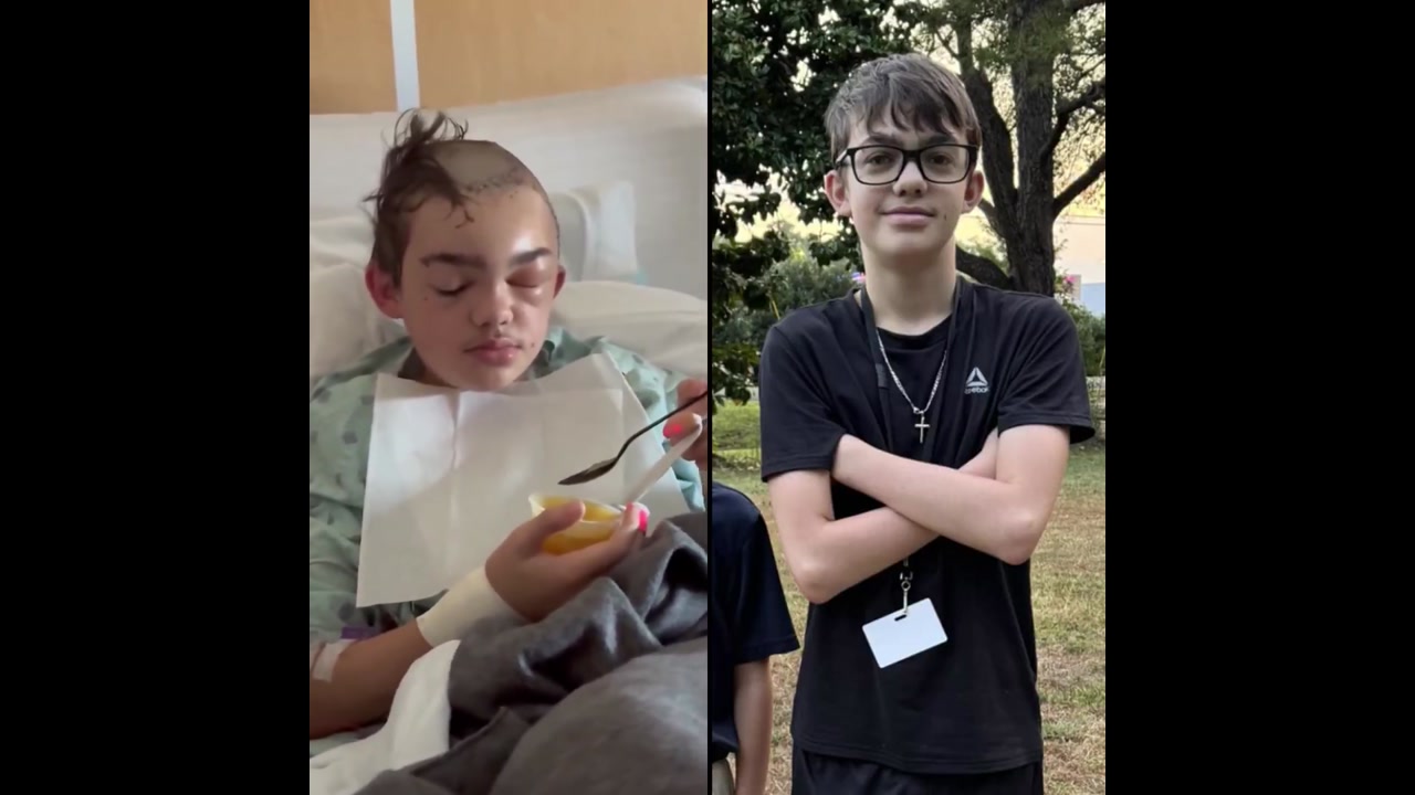 [Video] Texas Boy Hospitalized After Joke Escalates into Violent Attack